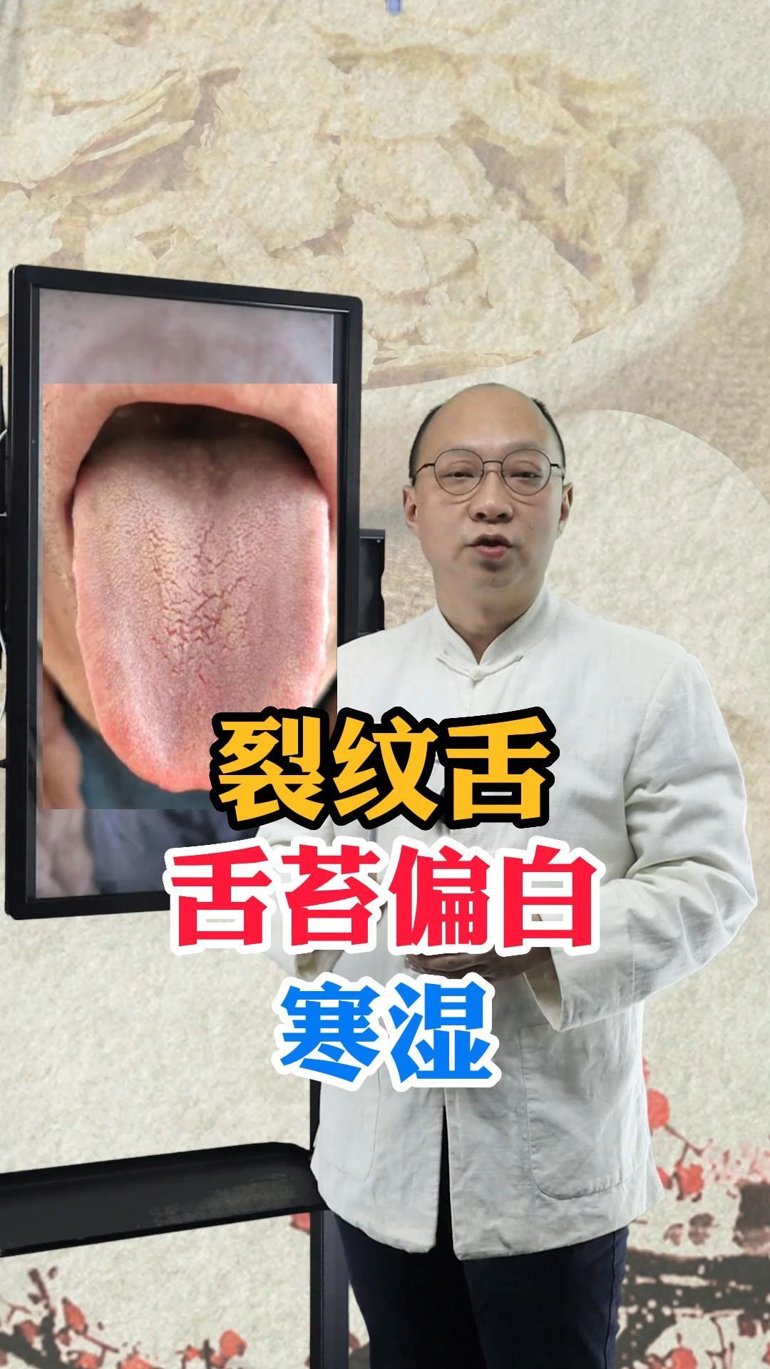 裂纹舌,舌苔白腻,寒湿引起来的