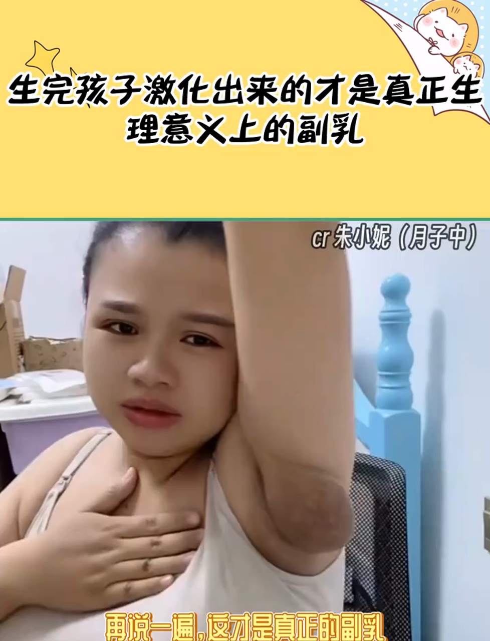 乳头是什么真实 副乳图片