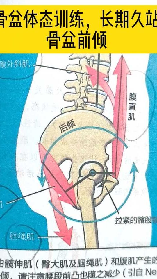 骨盆后倾的症状图片图片