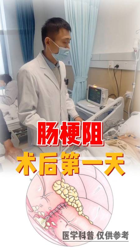 腹痛腹胀肠梗阻患者术后第一天