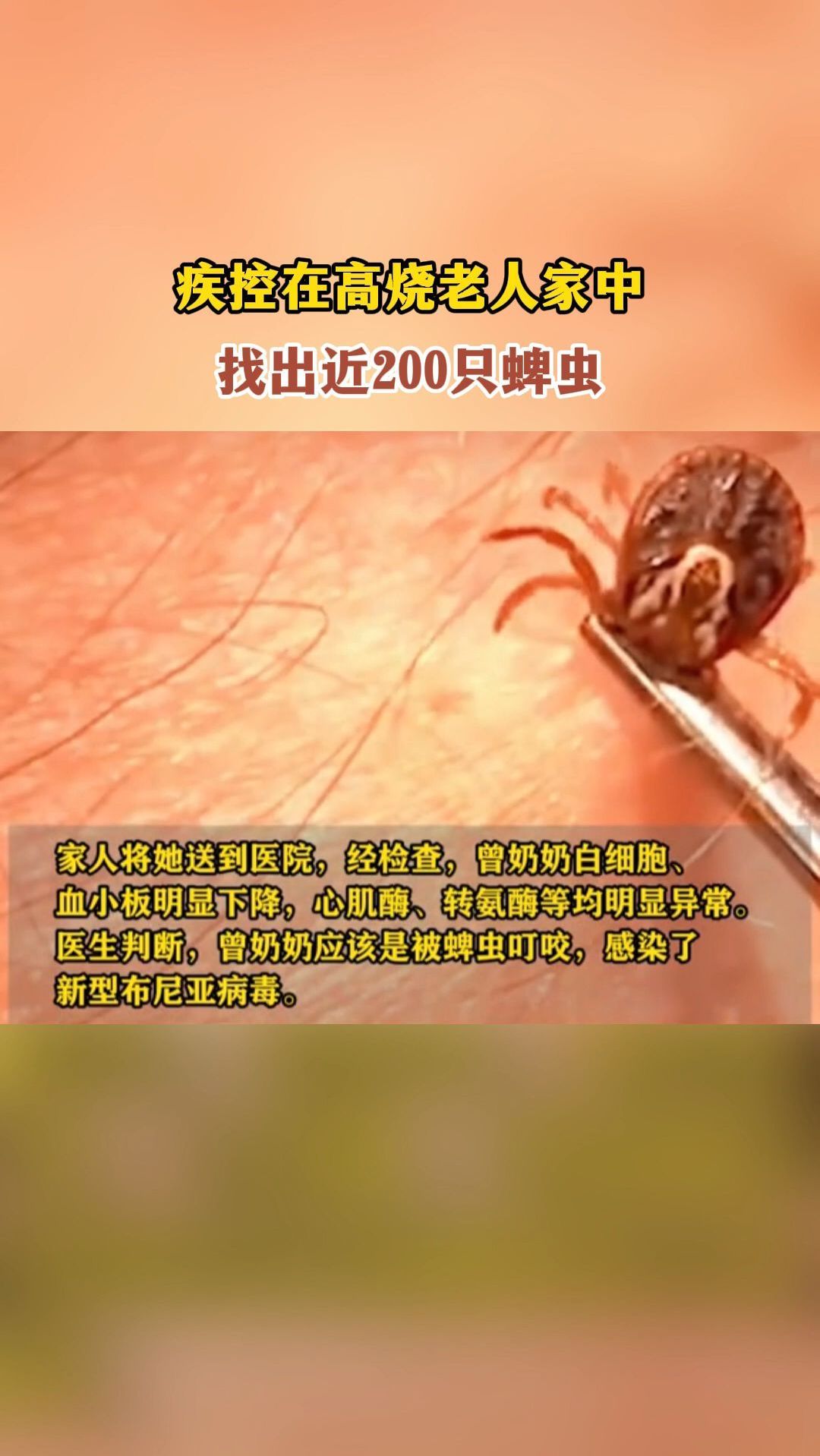 疾控在高烧老人家中找出近200只蜱虫