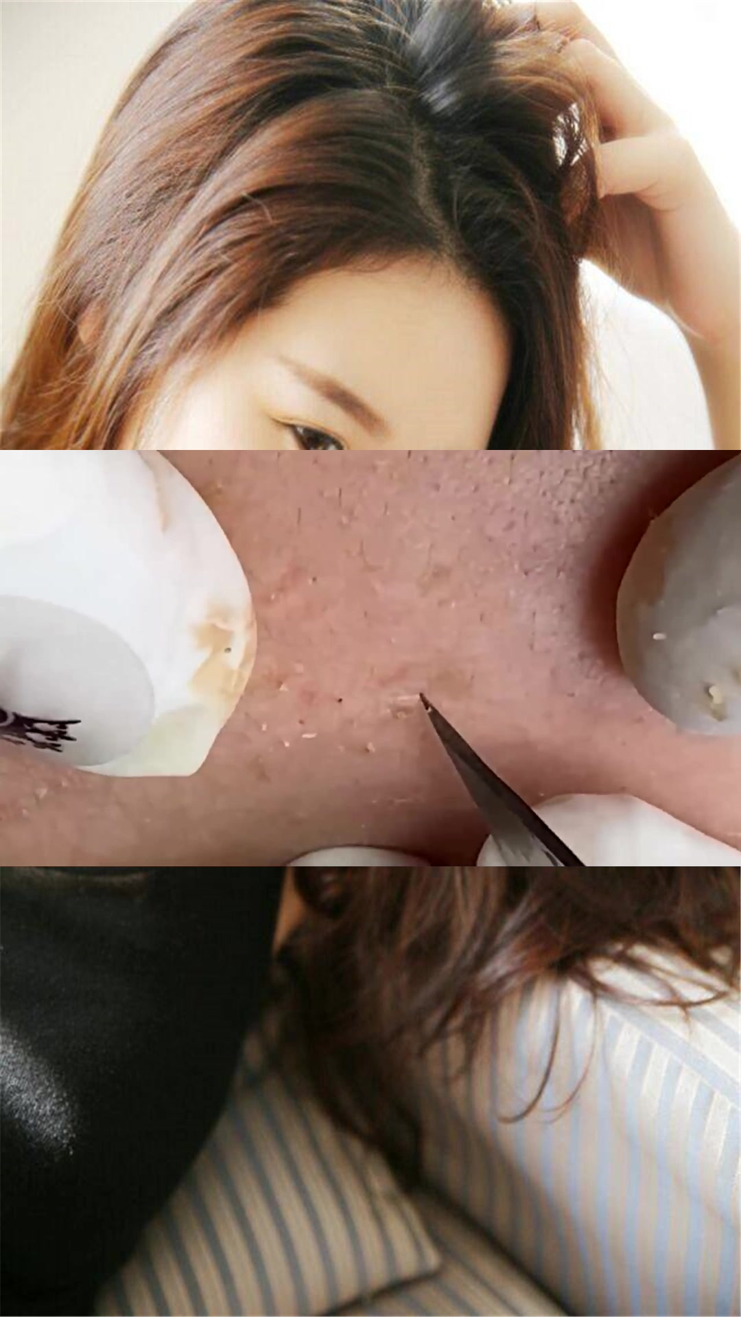 用手挤黑头易引起皮肤发炎,美容院的都在用这款工具!