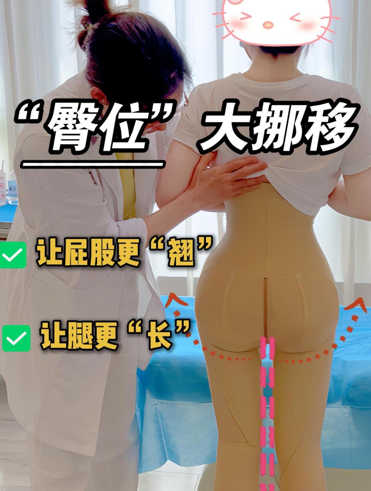 臀位如何调整能让屁股更翘让腿更长?