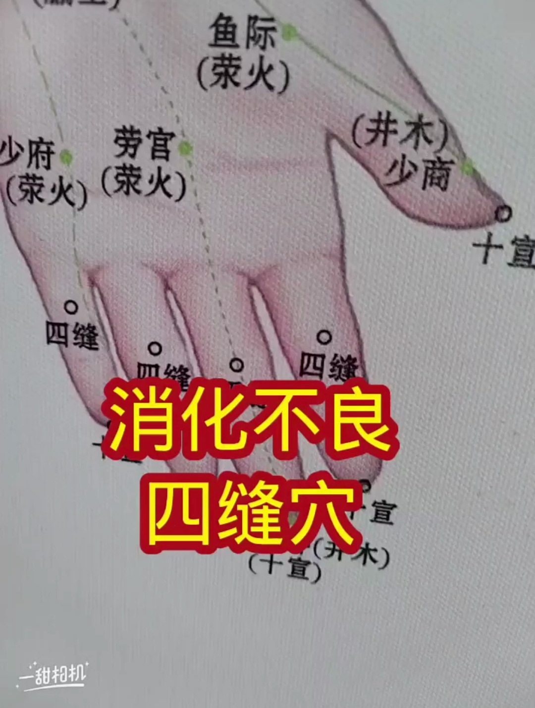 一招四缝穴,改善消化不良