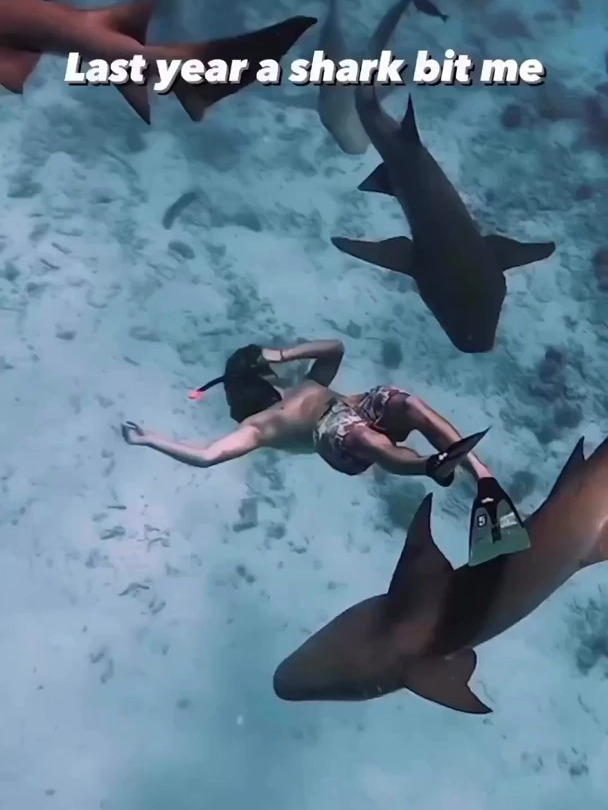 潜水员被护士鲨咬伤.他没有惊慌,做了正确的事