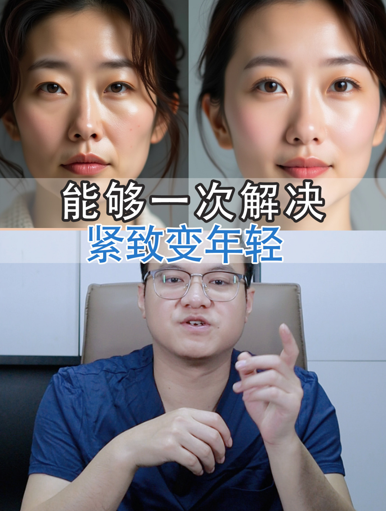 —小切口改善法令纹 提升苹果肌