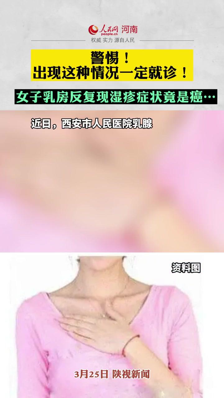 女子乳房反复现湿疹症状却是乳腺癌 最新发布 新闻 热点 最新消息