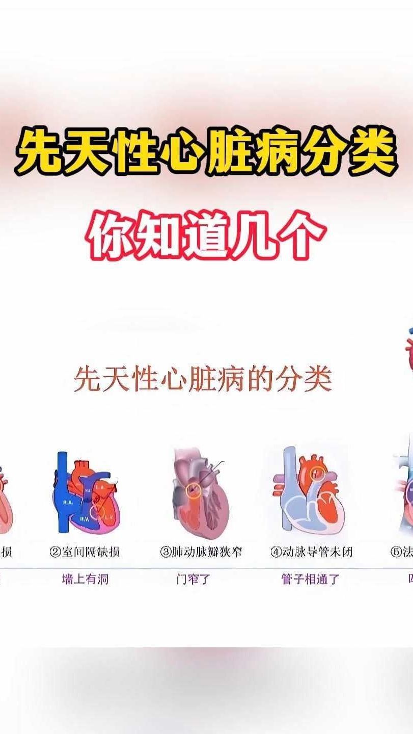 先天心脏为什么20几岁才发现 先天心脏为什么20几岁才发现