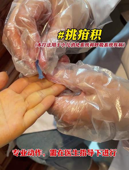 挑疳积法演示:适用于小儿消化系统和呼吸系统-度小视