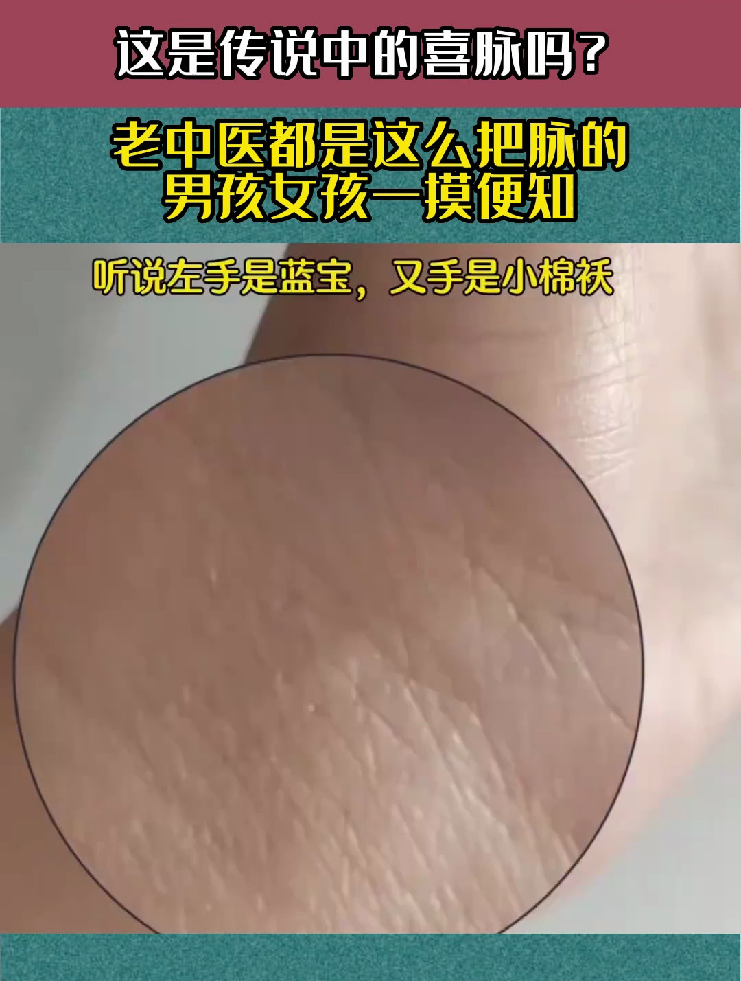 这是传说中的喜脉吗?老中医都是这么把脉的