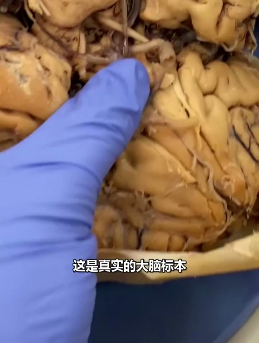 这是真实的人体大脑标本