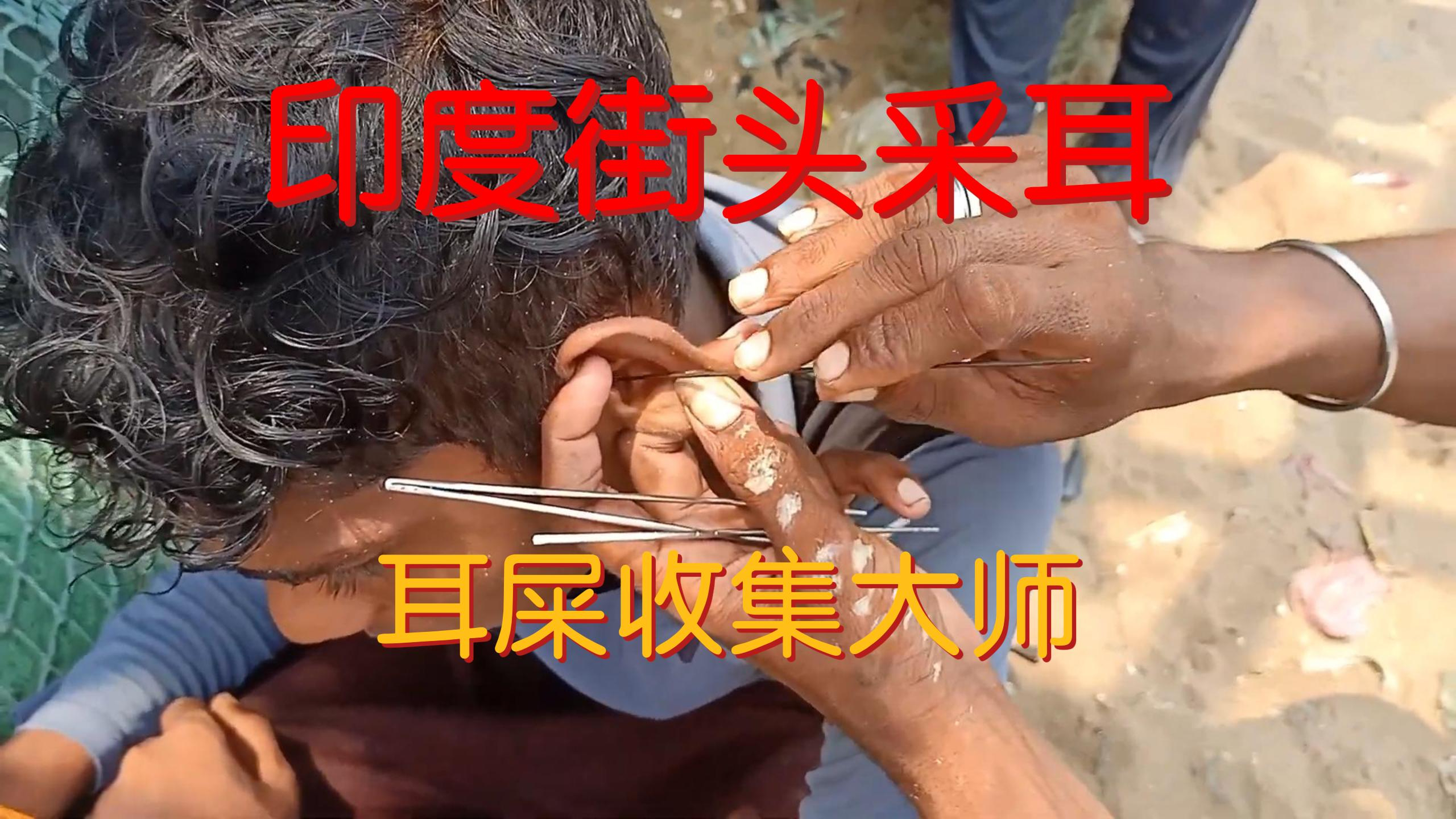 印度街头采耳:倒入特制药水!直接就是开始收集!