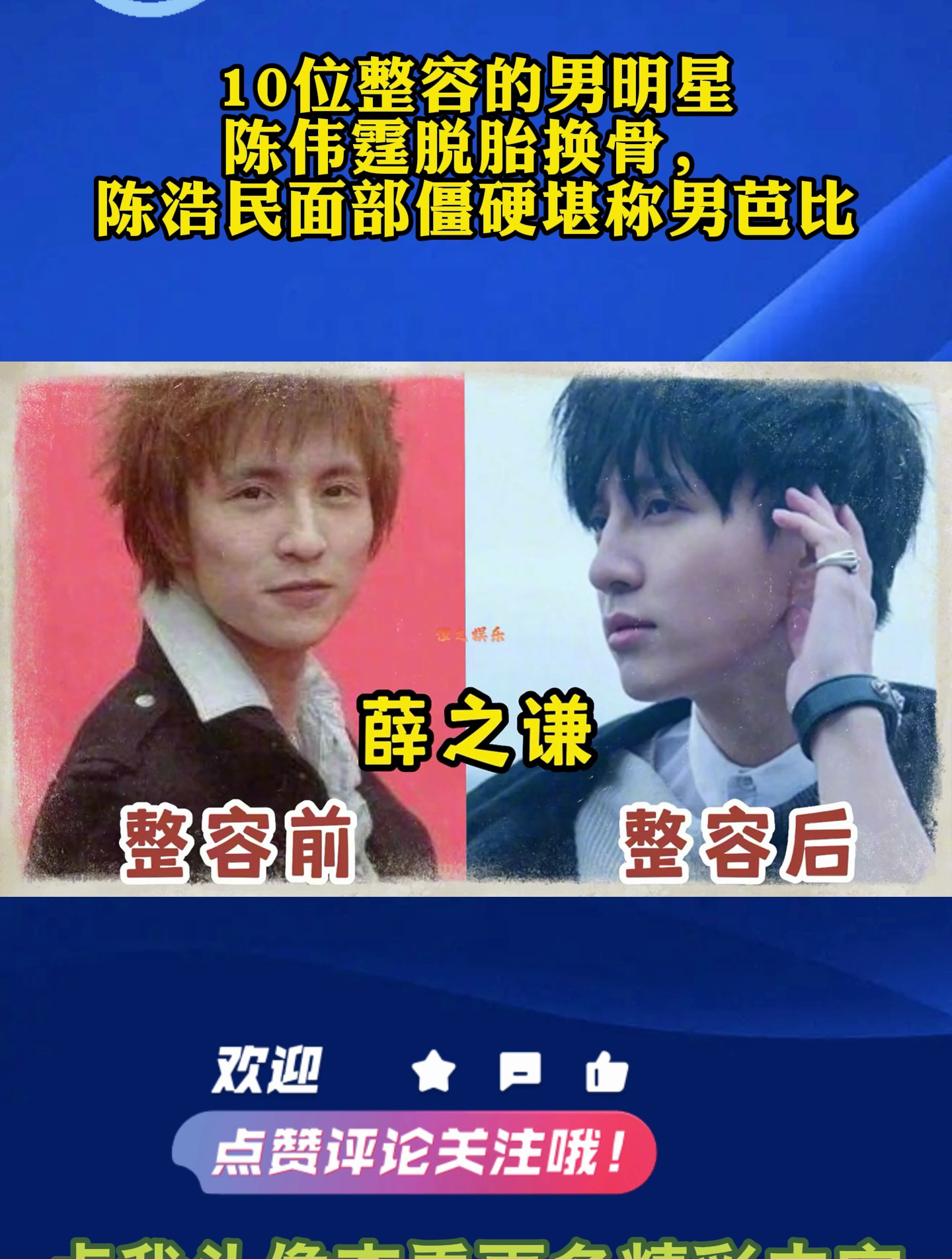10位整容的男明星陈伟霆脱胎换骨陈浩民面部僵硬堪称男芭比