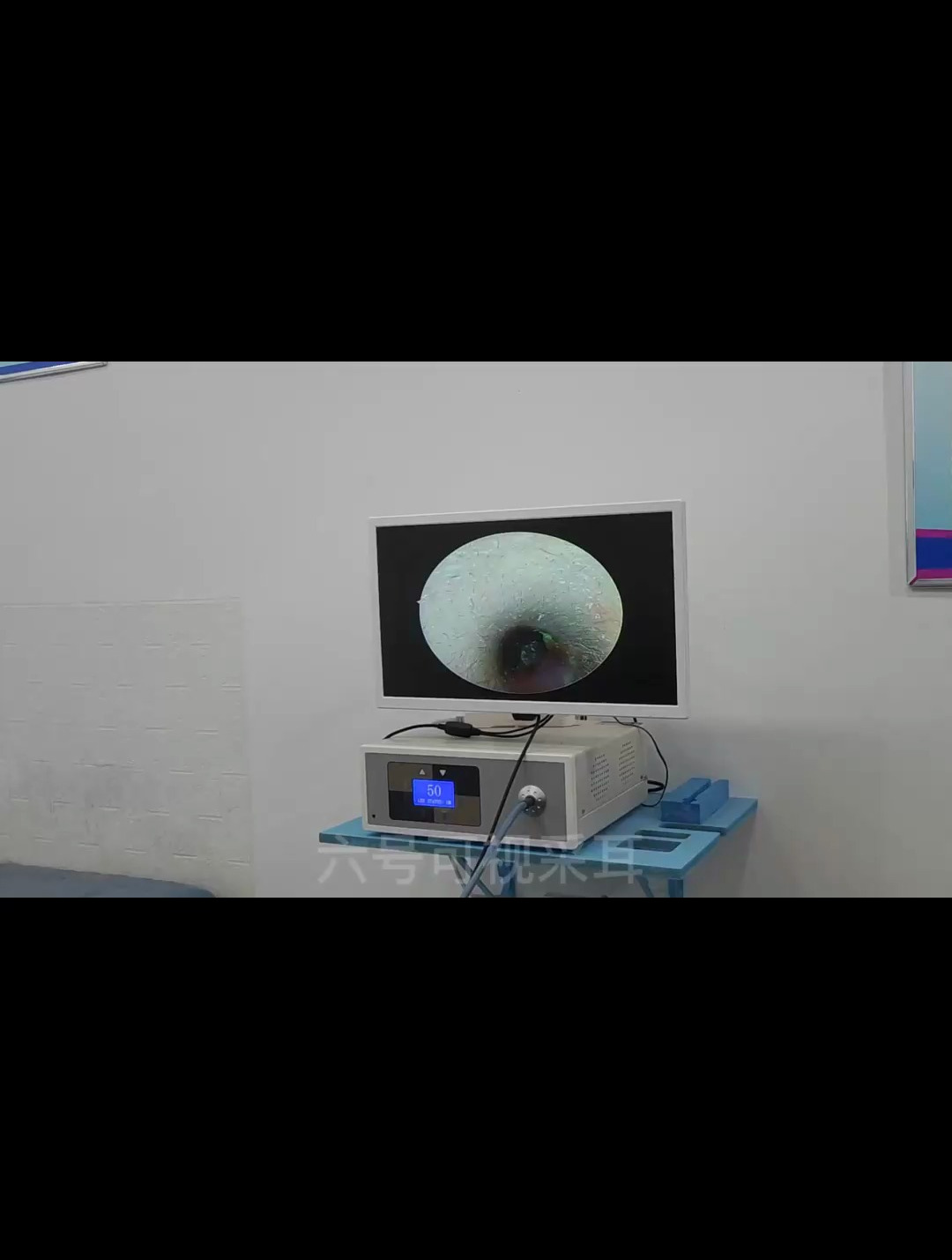 这是上个视频的另外一只耳朵,耳屎都是黑色的,看得我心里都堵堵