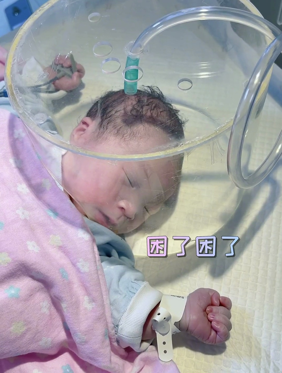 早产新生儿在乖乖吸氧,不哭也不闹听话的让人心疼