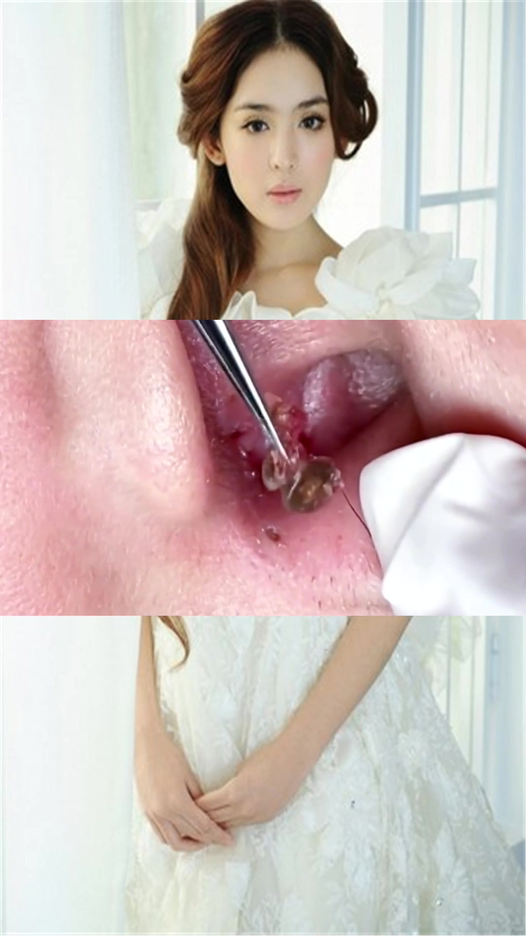 用手挤黑头危害太大,这款去黑头神器,这个真心好用-度小视