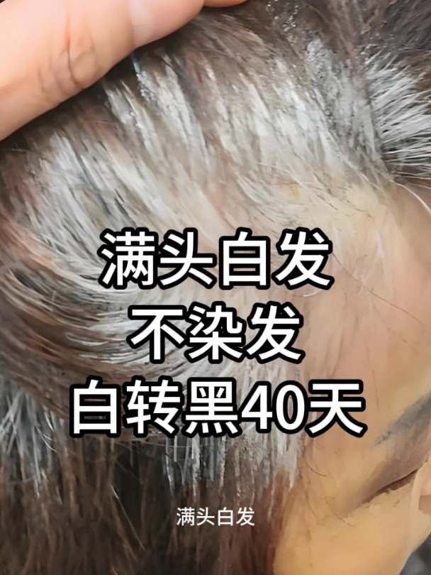 满头白发:不染发,白转黑40天