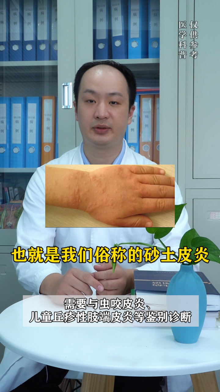 宝宝手上红色皮疹沙土皮炎怎么办