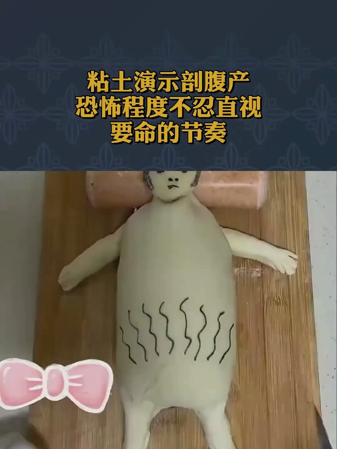 粘土演示剖腹产,恐怖程度不忍直视!要命的节奏