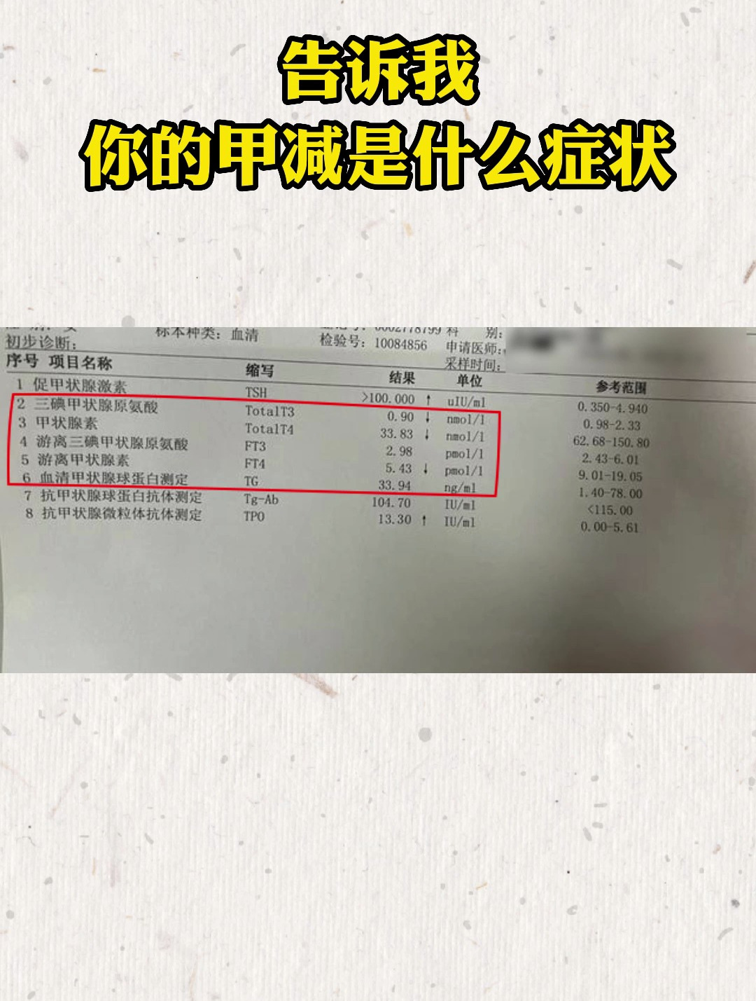 甲减的症状与危害女性(孕期甲减的症状与危害女性)