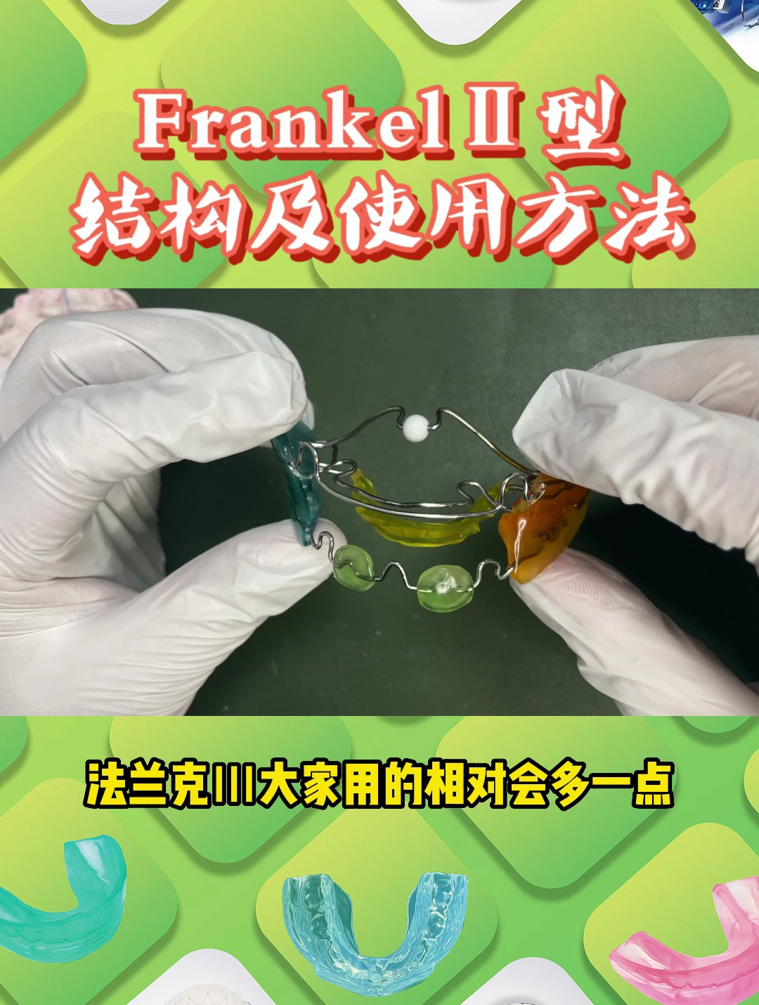 frankel Ⅱ的结构及使用方法 妃她正畸