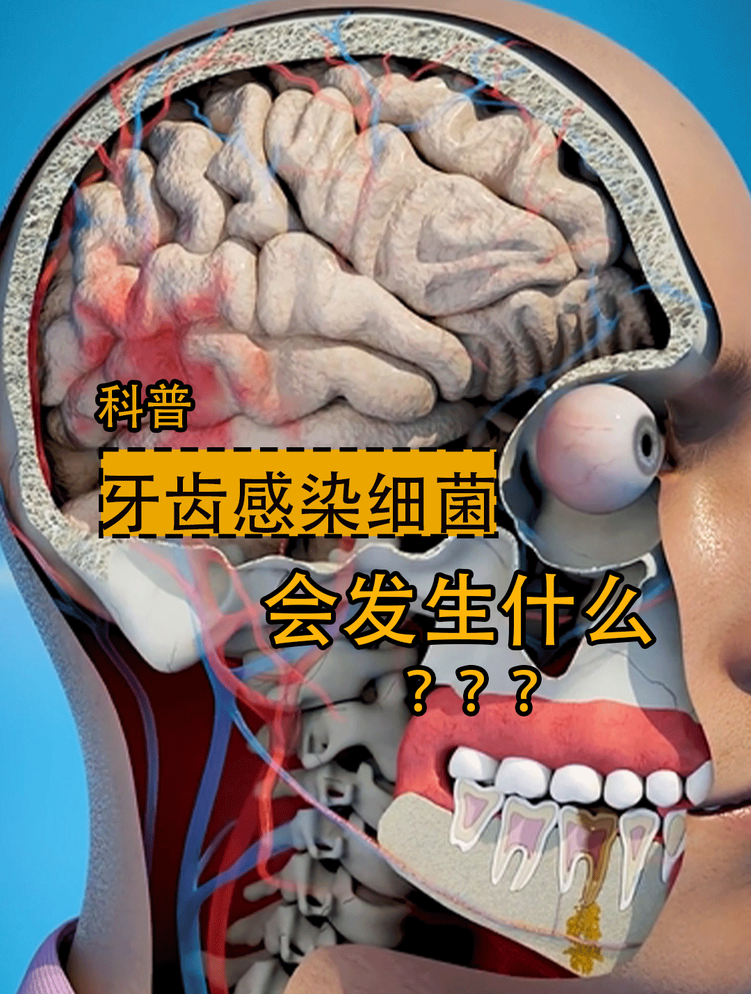 如果牙齿被细菌感染,会发生什么情况?大脑血管突然破裂,会怎样