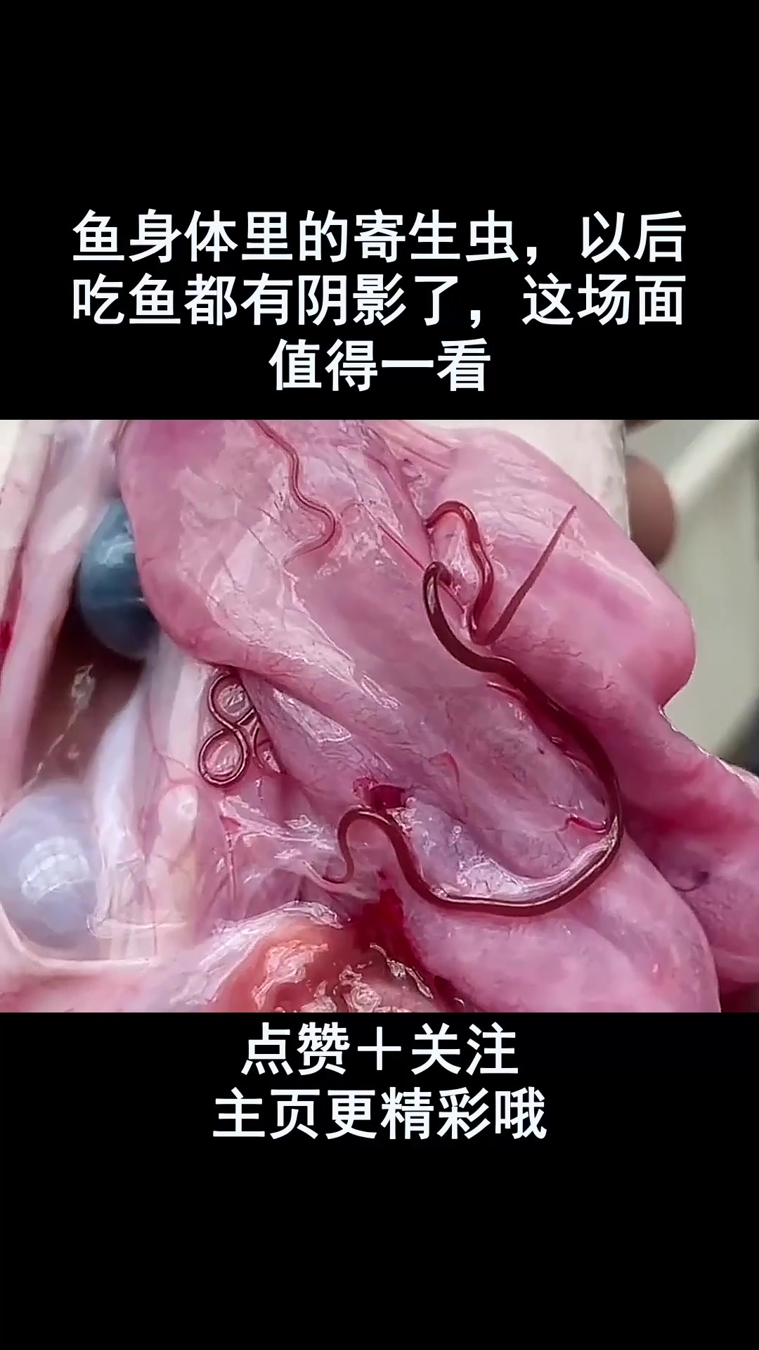 鱼身体里的寄生虫,以后吃鱼都有阴影了,这场面值得一看