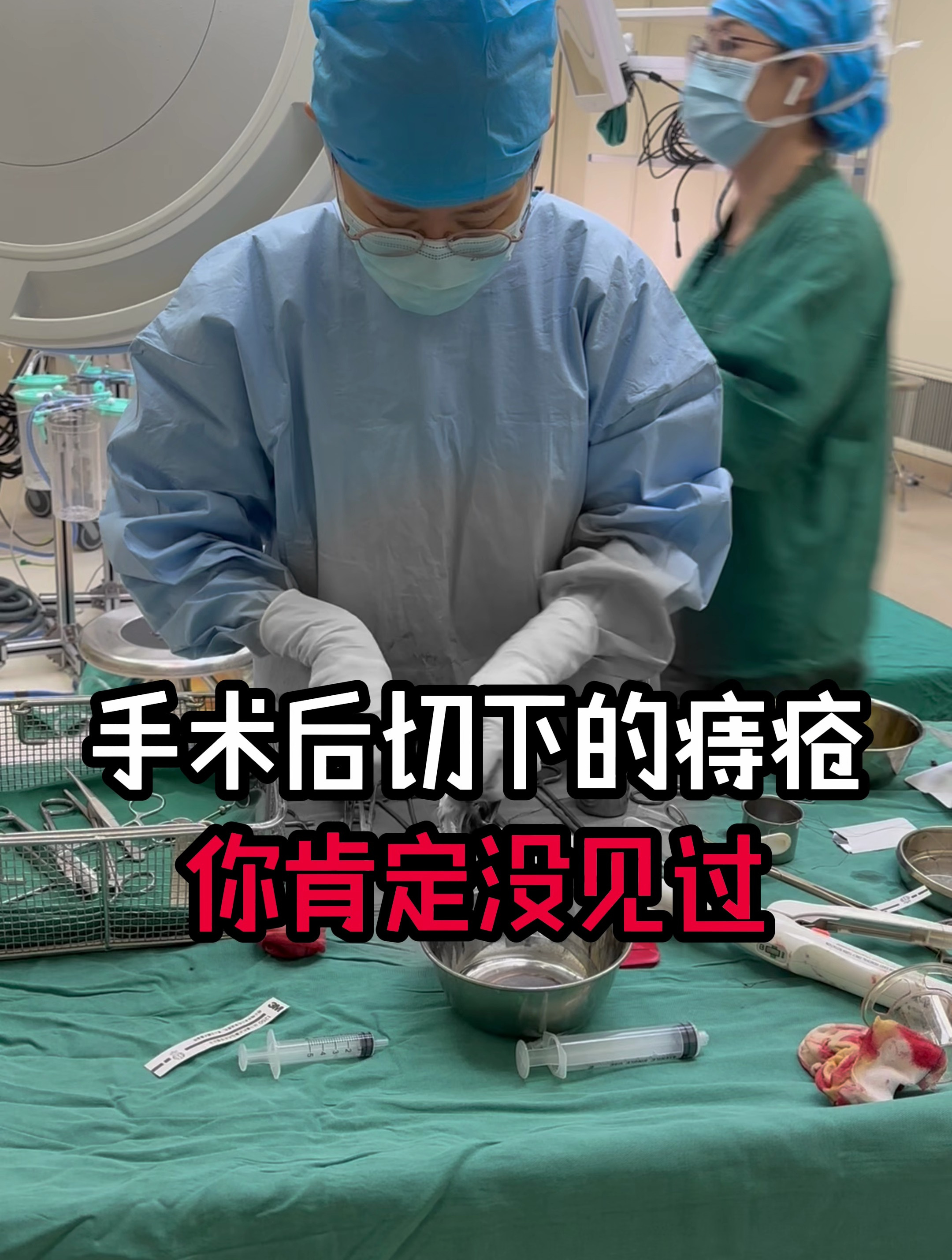 手术后切下的痔疮,你肯定没见过?