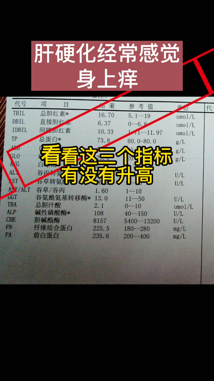 肝硬化经常感觉身上痒,看看这三个指标