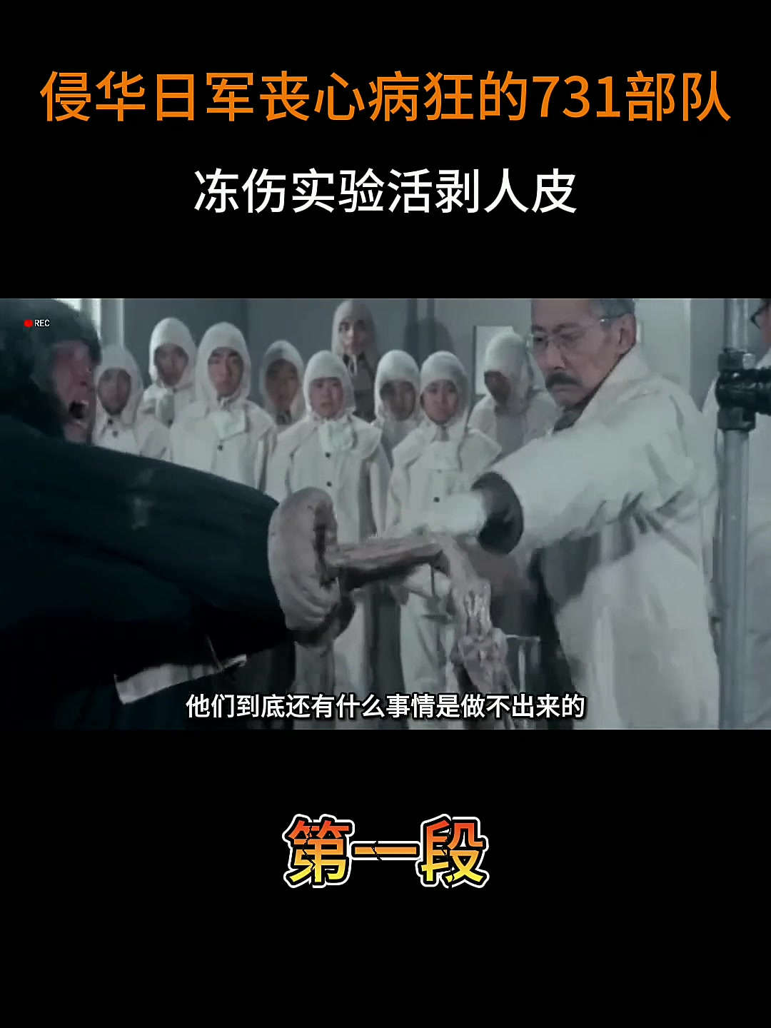 侵华日军丧心病狂的731部队,冻伤实验活剥人皮,画面惨不忍睹
