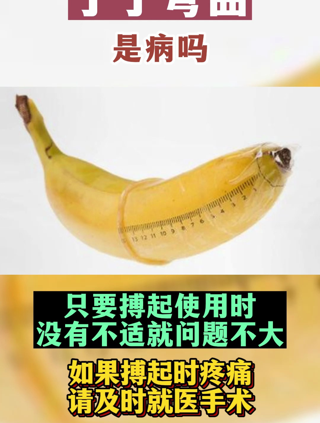 丁丁弯曲是一种病嘛