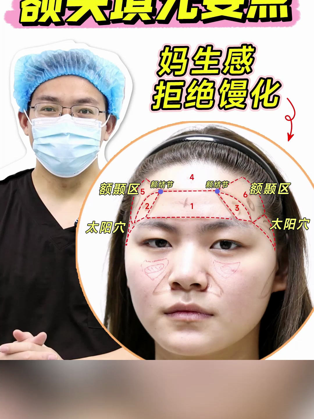 额头怎么填充才能不馒化?李院长来教你!