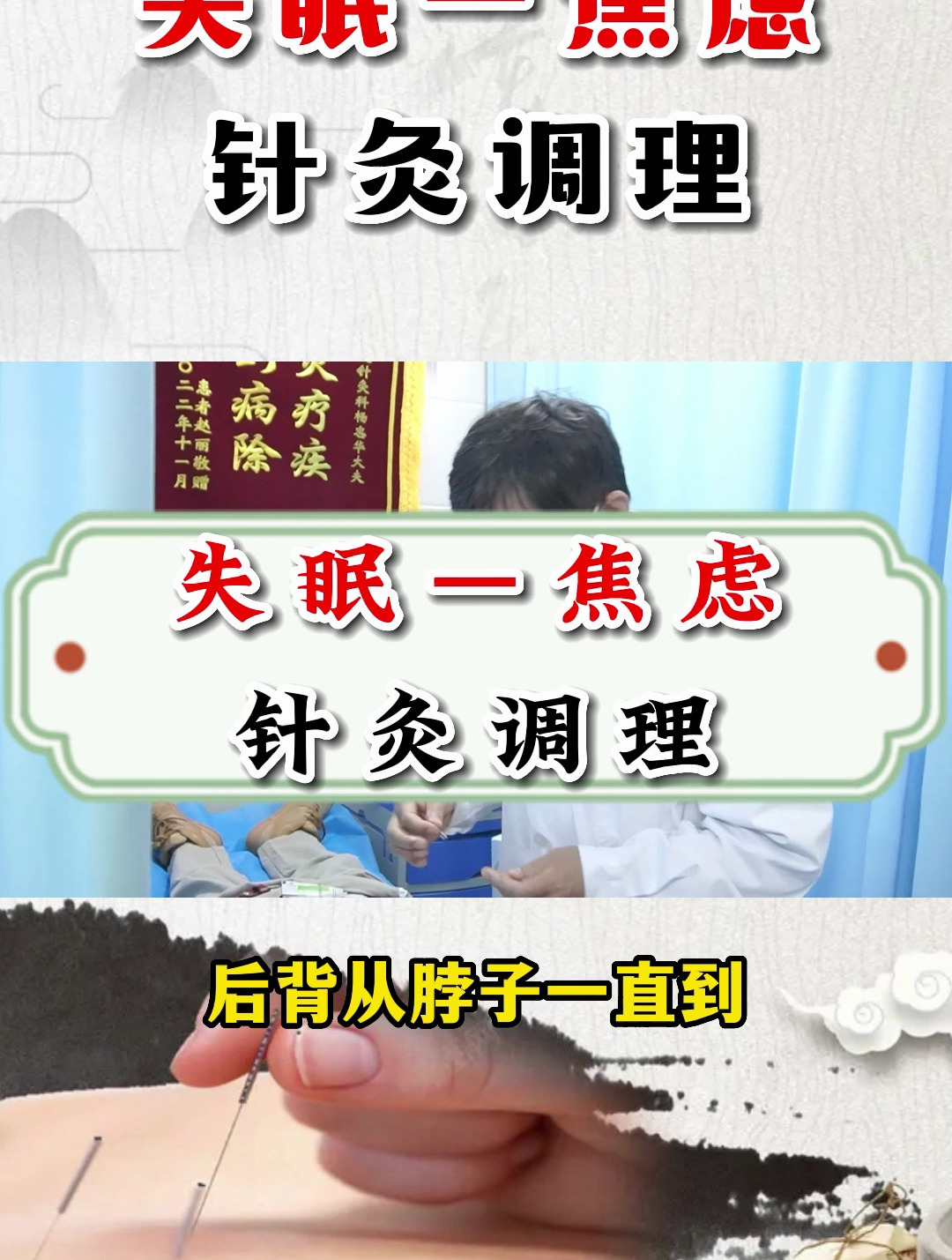 失眠—焦虑,针灸调理