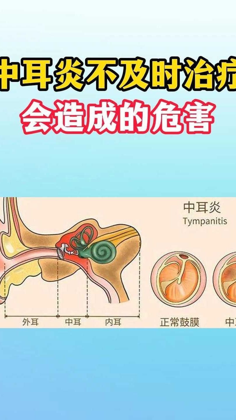 中耳炎不及时治疗会造成的危害