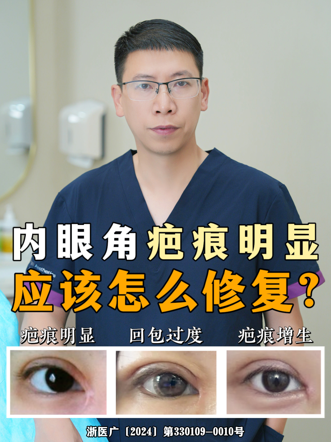 开过内眼角,哪些问题需要修复?