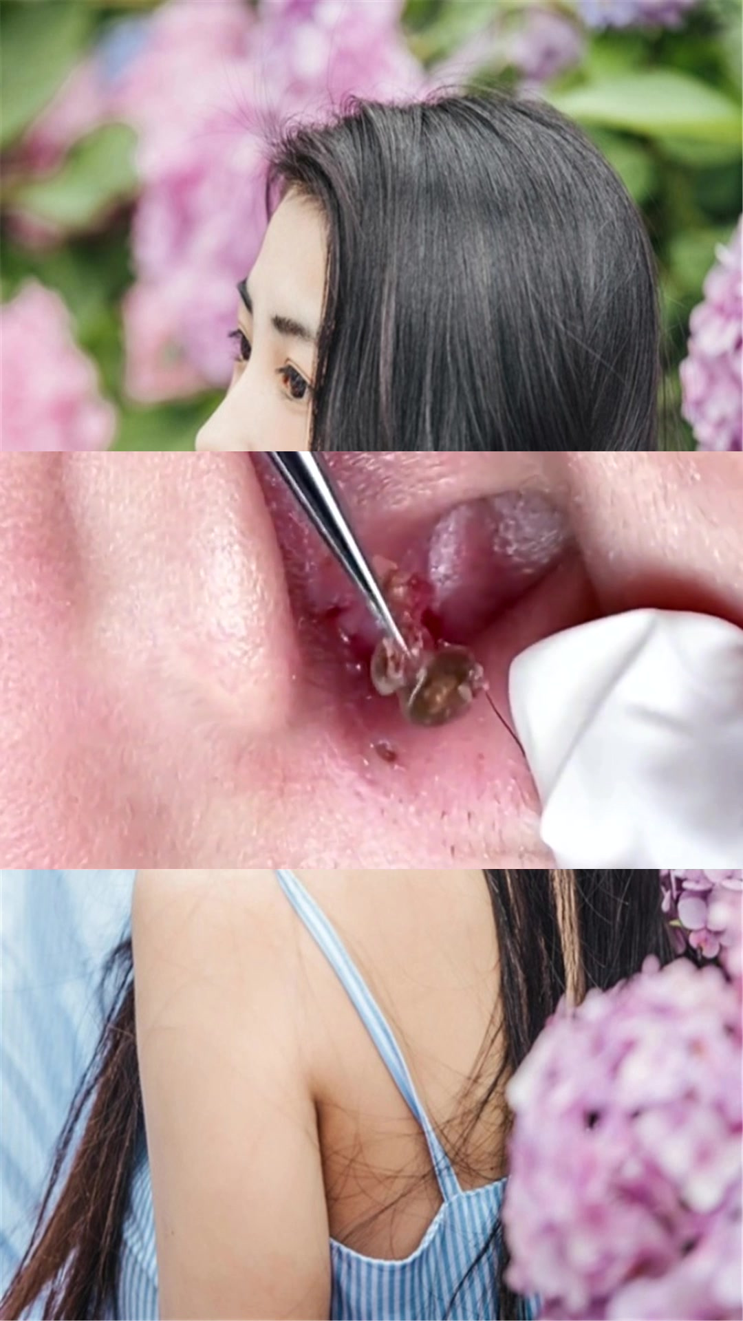 用手挤黑头危害太大,这款去黑头神器,高效有用