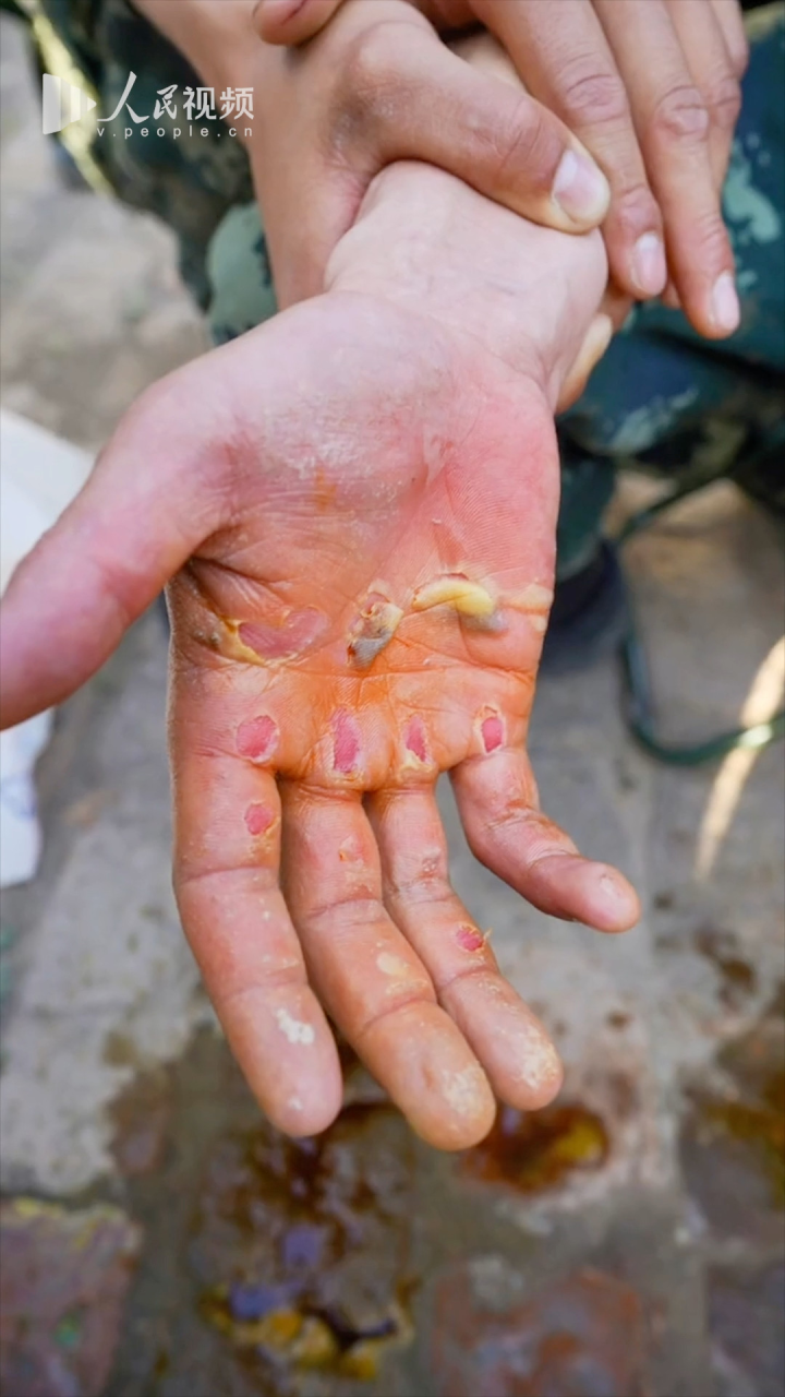 武警特战队员完成345个单杠卷身上手掌破皮令人心疼