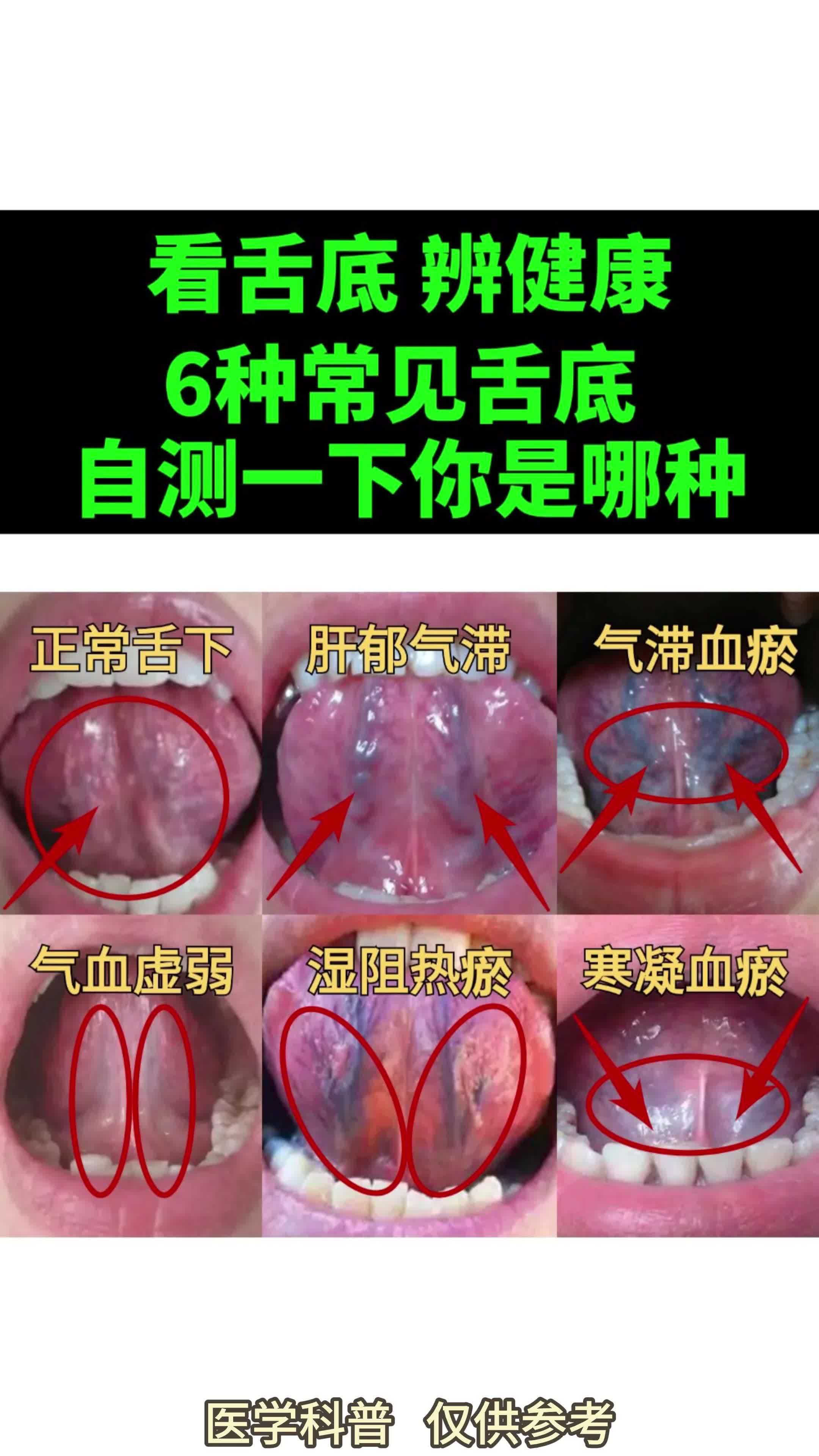 舌下构造图图片