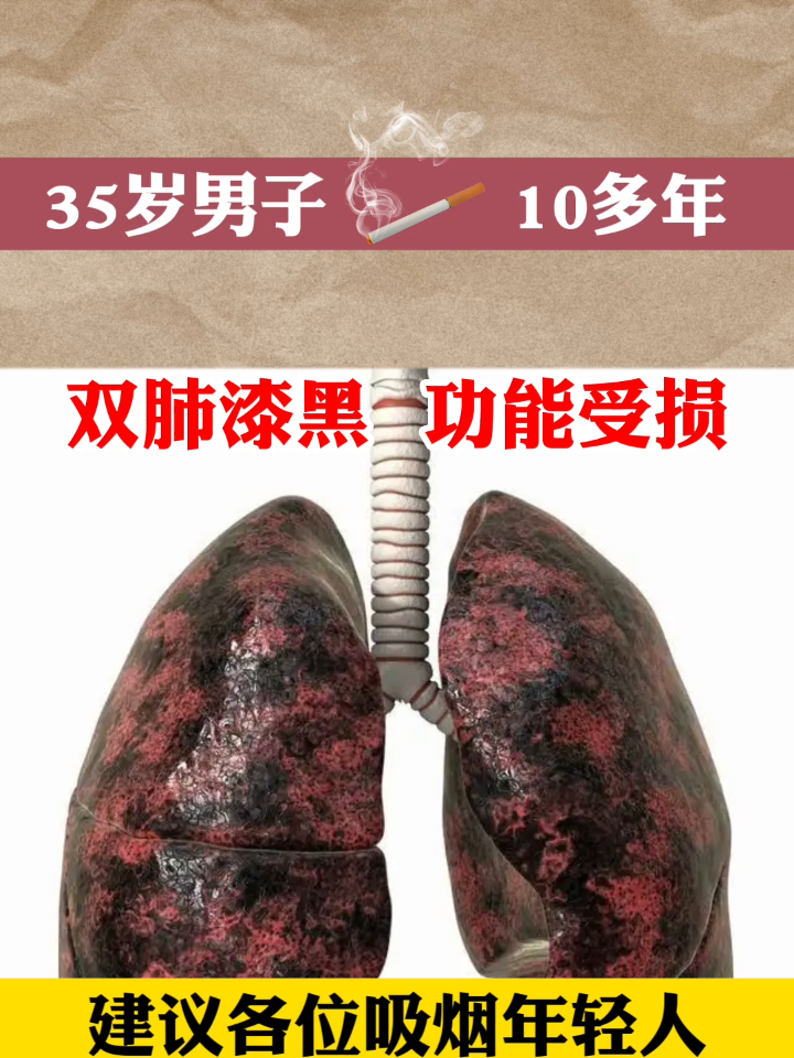 北京三甲专家荣毅主任告诉你,吸烟者的肺是什么样的?
