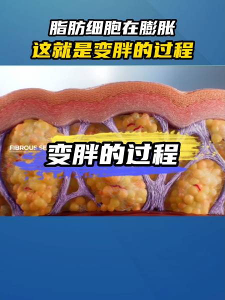 脂肪细胞在膨胀这就是变胖的过程