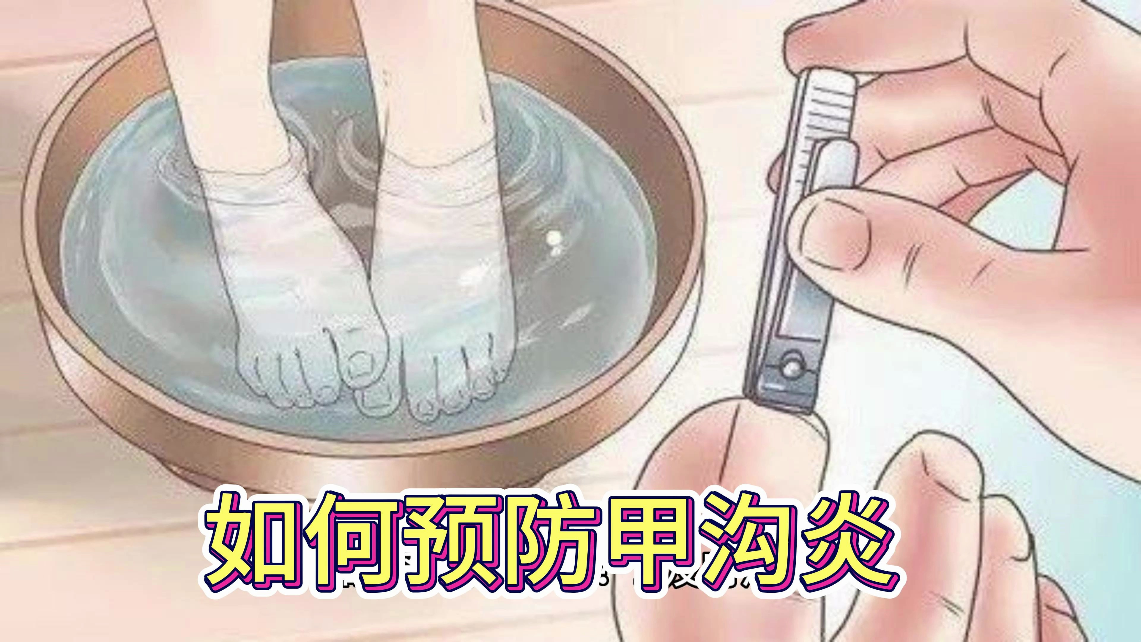 为什么会得甲沟炎?如何预防甲沟炎?