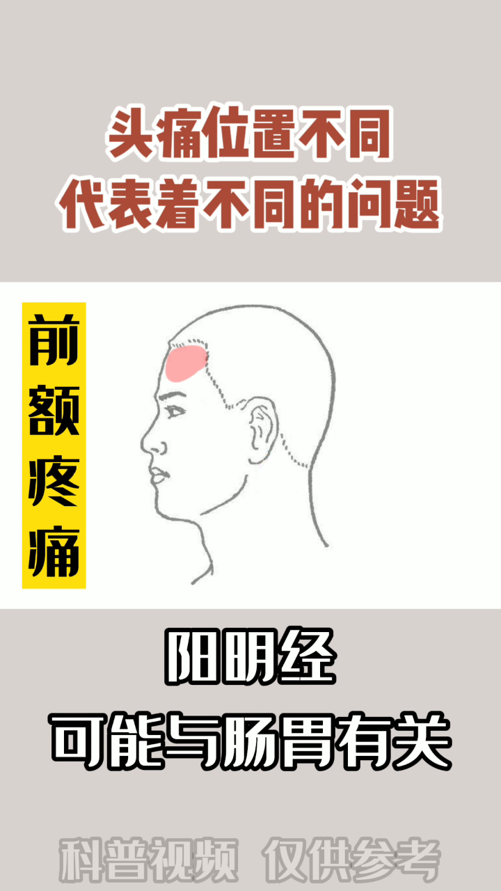 头痛位置 不同,代表问题也不同?