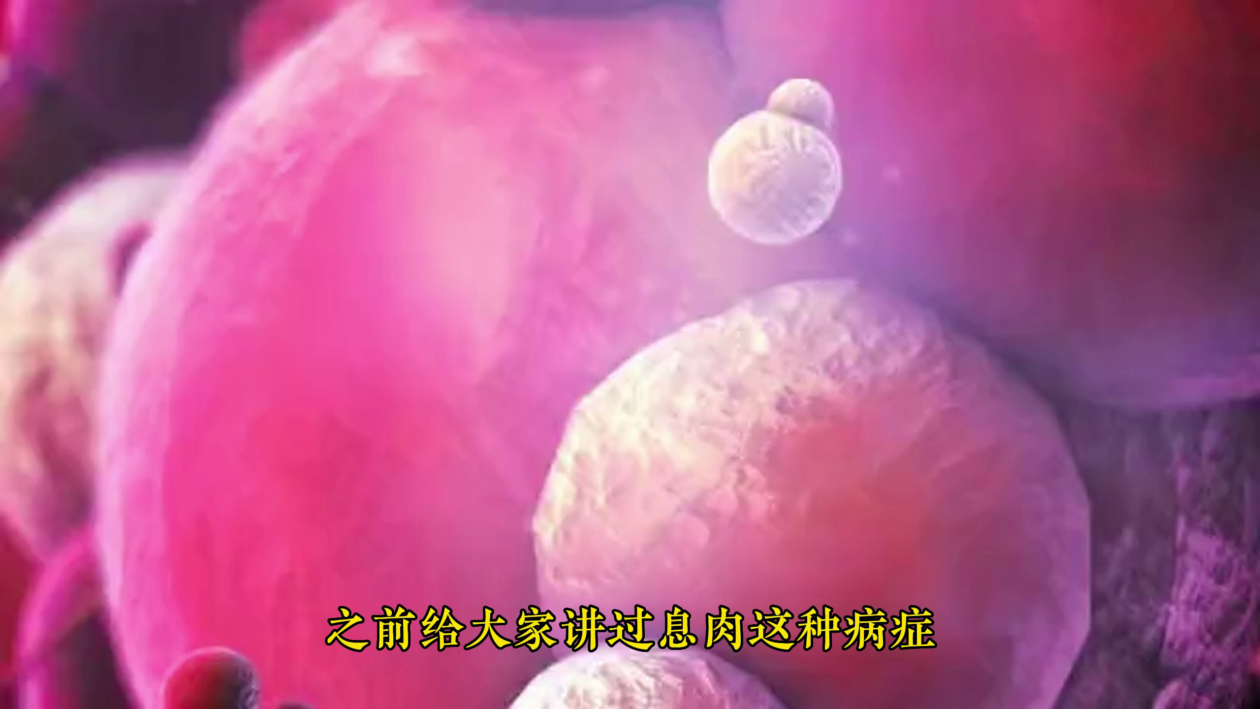 痰瘀凝滞则息肉内生!一个古方调理,可自然脱落,不用手术