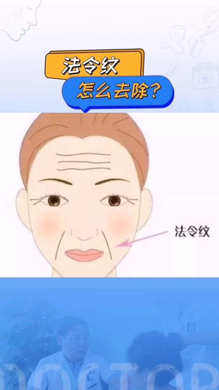 法令纹怎么去除听听主任怎么说