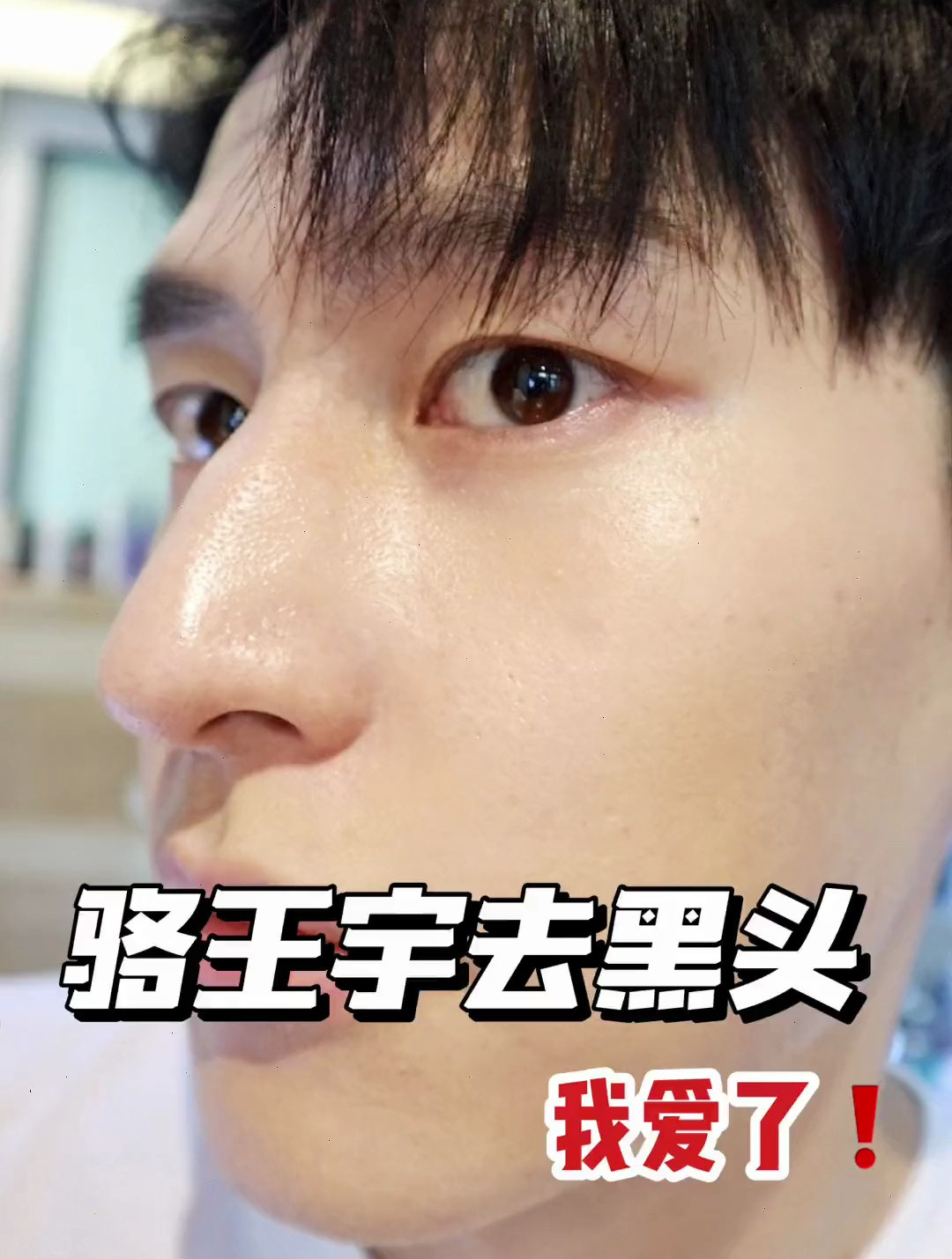骆王宇没有骗我这个去黑头绝了