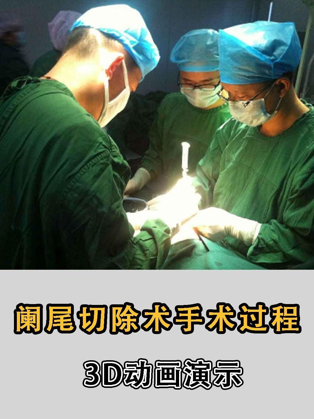 阑尾炎切除手术的过程