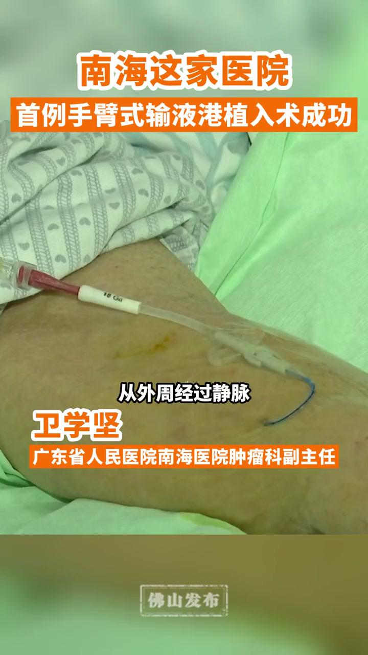 成功開展南海首例手臂式輸液港植入術佛山醫院輸液中廣東dou知道手術