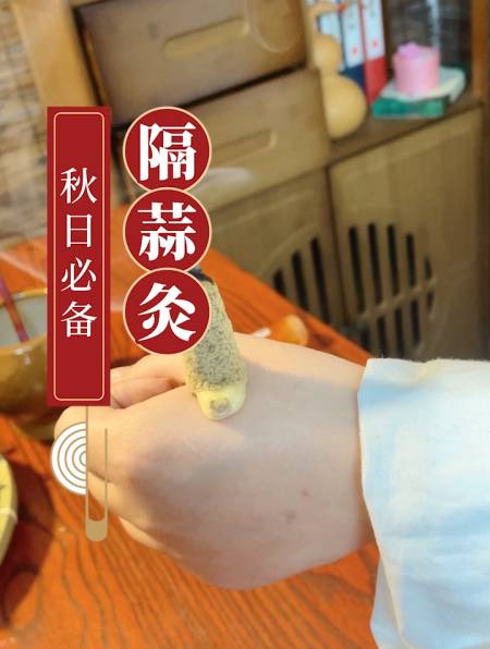 艾灸馆同款隔蒜灸,常灸常舒心-度小视