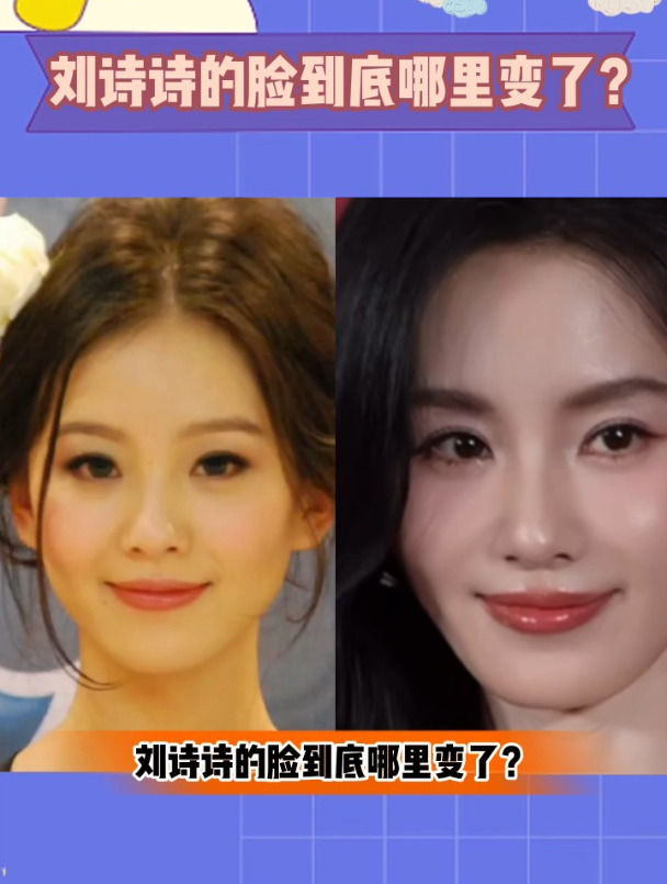 刘诗诗的脸哪里变了?和以前不一样 在她脸上看到很多女星的影子