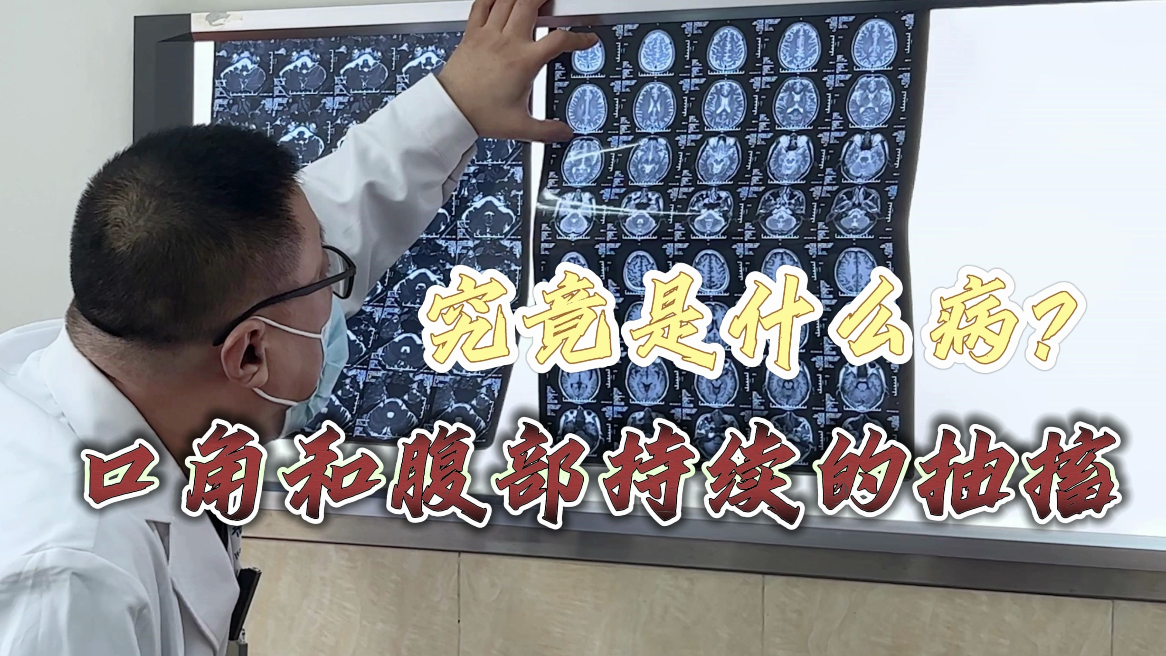 怪事儿?口角和腹部持续的抽搐,男子究竟得的是什么病